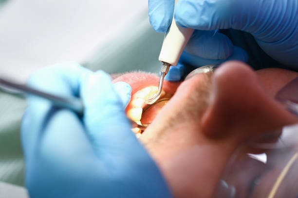 Best Teeth Whitening  in Mitchell, IL